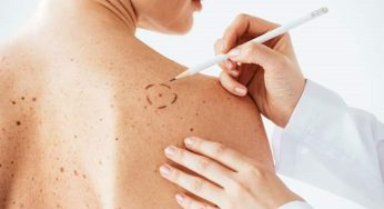 Aumento de cáncer de piel en Chile: Cinco señales que no debes ignorar