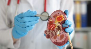 En el marco de la semana del riñón: Fundación Pro Salud Renal hace llamado a prevenir y tratar a tiempo las enfermedades asociadas a los riñones