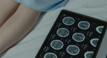 Casos de afasia aumentan junto con una mayor prevalencia de los accidentes cerebro vasculares