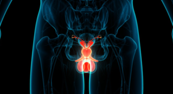 Cáncer testicular predomina en jóvenes chilenos