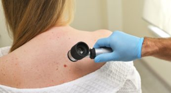 Precisan diagnósticos de cáncer de piel de tipo melanoma con Inteligencia Artificial