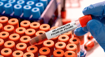 Helicobacter pylori: la bacteria silenciosa que puede desencadenar cáncer gástrico si no se completa el tratamiento